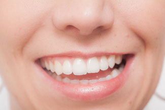 歯並び　噛み合わせ　顎の曲がり
片方の歯でかみ続けるとあごや顔が変形する
