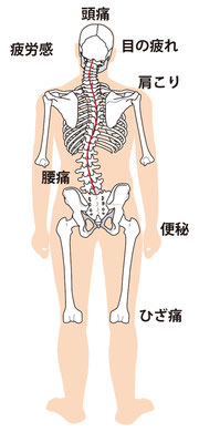 腰の痛みの種類と症状
